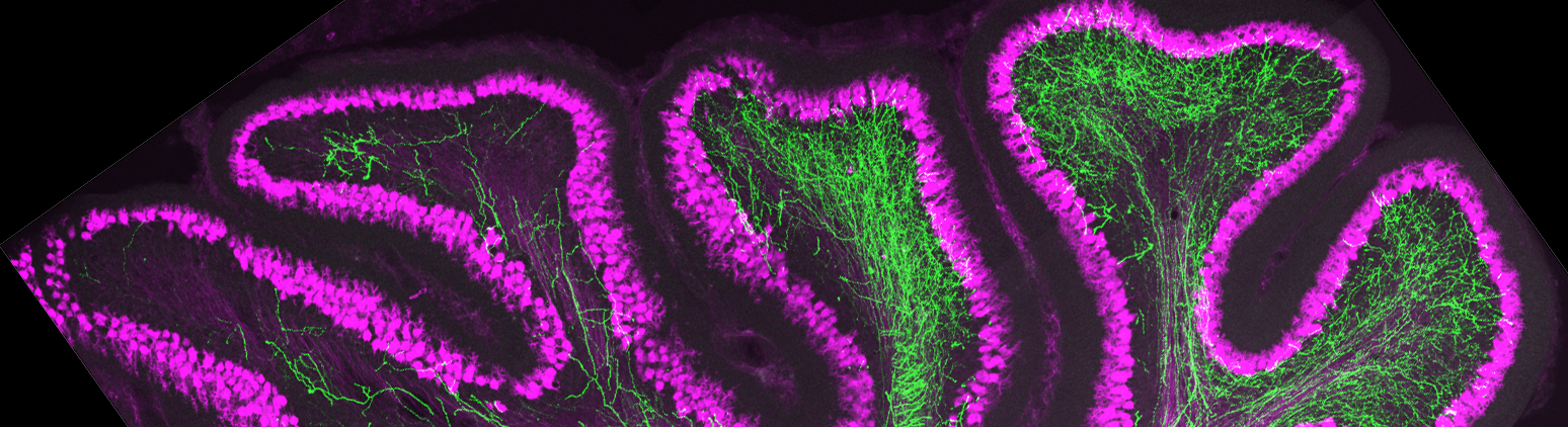 Neuronal Synapse Formation and Plasticity
25 Years